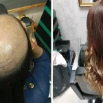 hair patch services